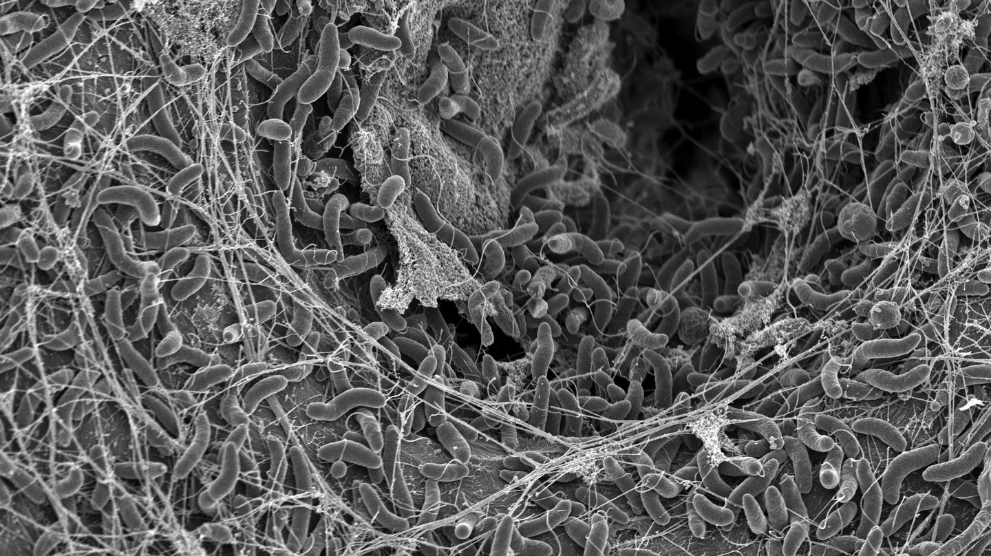 Vibrio cholerae bacteria, photo taken with a Scanning Electron Microscope. 2025 EPFL/Graham Knott et Melanie Blokesch - CC-BY-SA 4.0